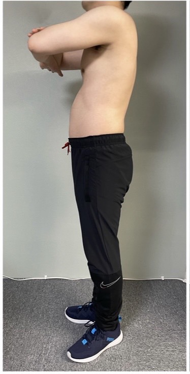 Before: ダイエット
