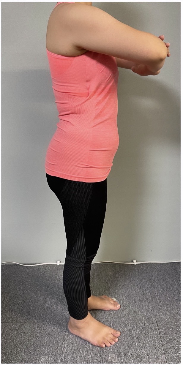 産後ダイエット Before