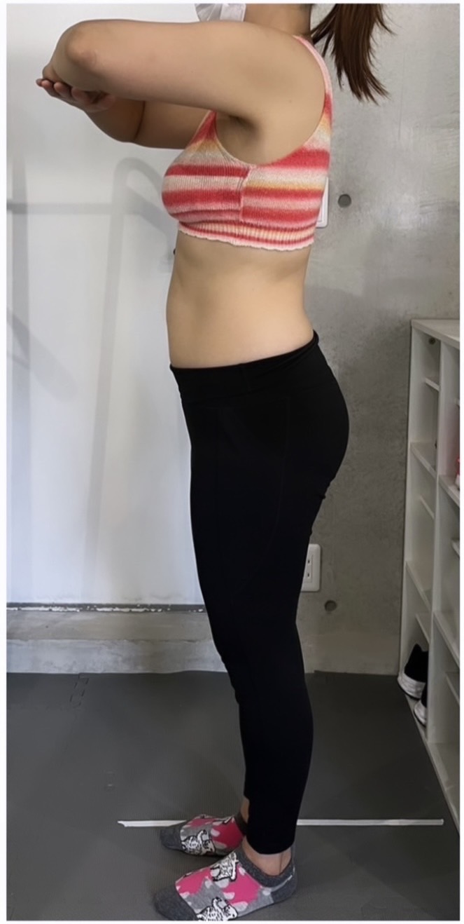 After: 反り腰改善・ダイエット