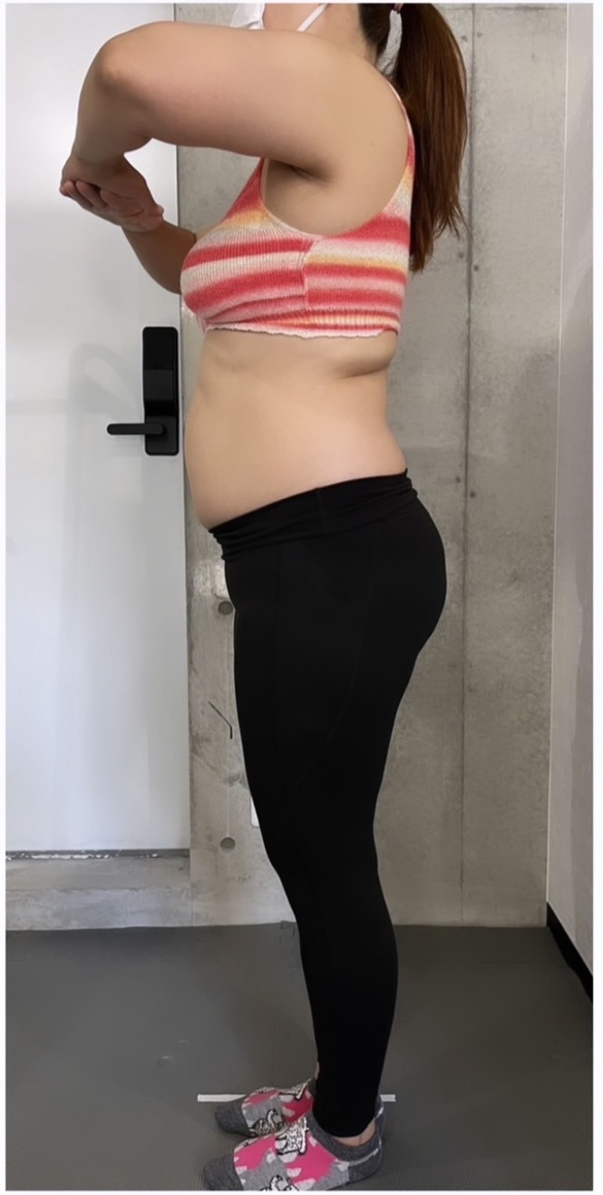 Before: 反り腰改善・ダイエット